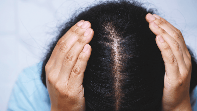 Traction Alopecia When Is It Too Late: Early sign and solutions