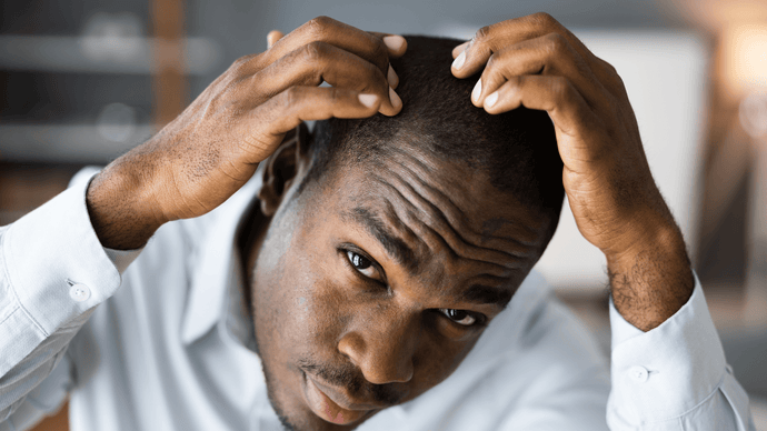 8 Different Types of Male Hairlines Explained + How To Maintain It