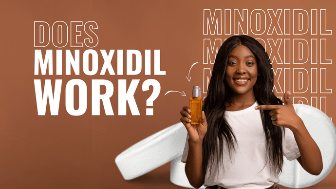 Does Minoxidil Work on Hairline? Here's What We Found