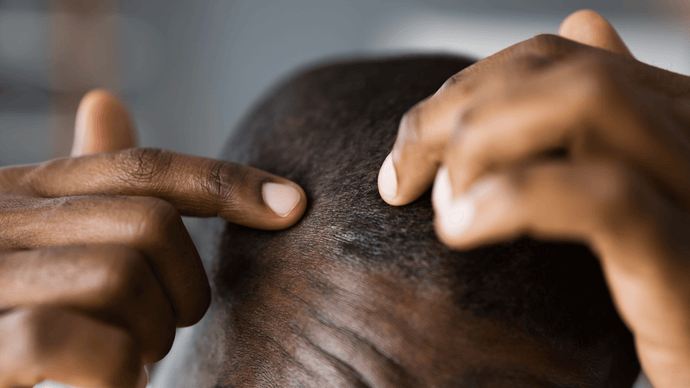 How To Grow Black Male Hair Faster: Proven Tips And Tricks
