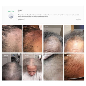 One Month Free Follicle Enhancer - Post Free Trial